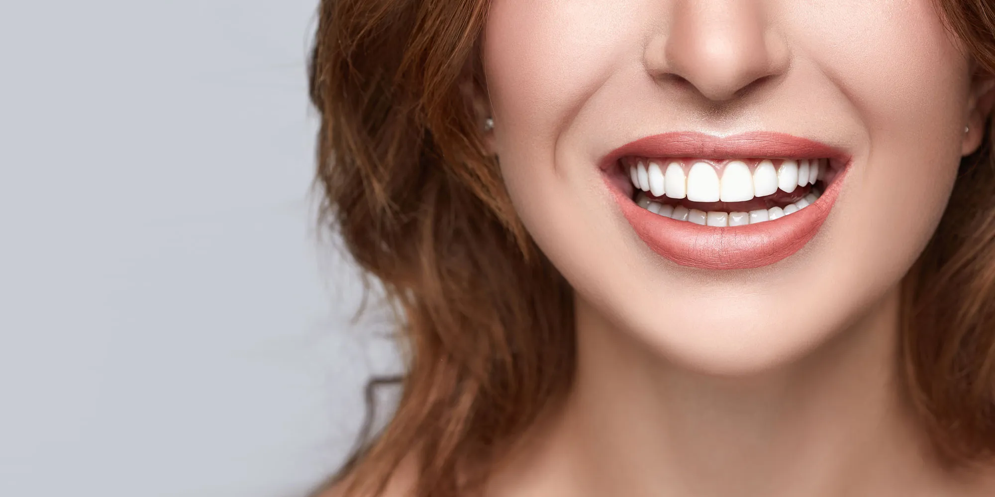 Is a Smile Makeover Worth It? Benefits, Costs & Results Is a Smile Makeover Worth It